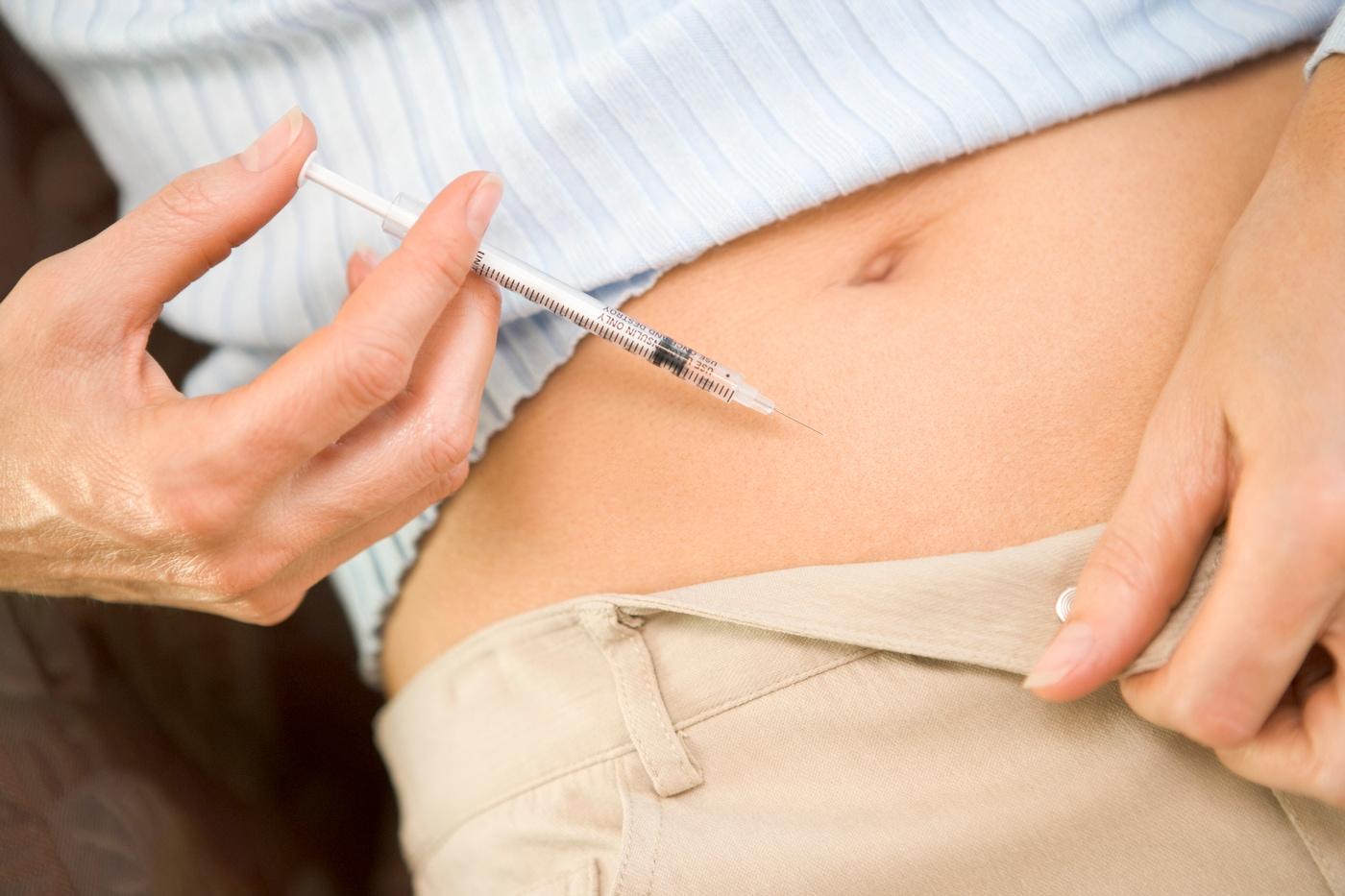 &#40;이미지투데이&#41;