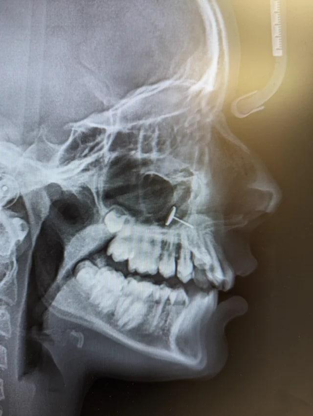 본문 이미지 - (사진=레딧 Reddit u/Scared_Category6311)