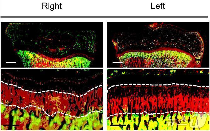 본문 이미지 - 왼쪽 정강이뼈 성장판으로부터 10㎜떨어진 곳에 구멍을 만든 뼈가 정상적인 뼈보다 성장 자극 효과가 뛰어난 것으로 보여주는 사진.(해운대백병원 제공. 재판매 및 DB 금지)