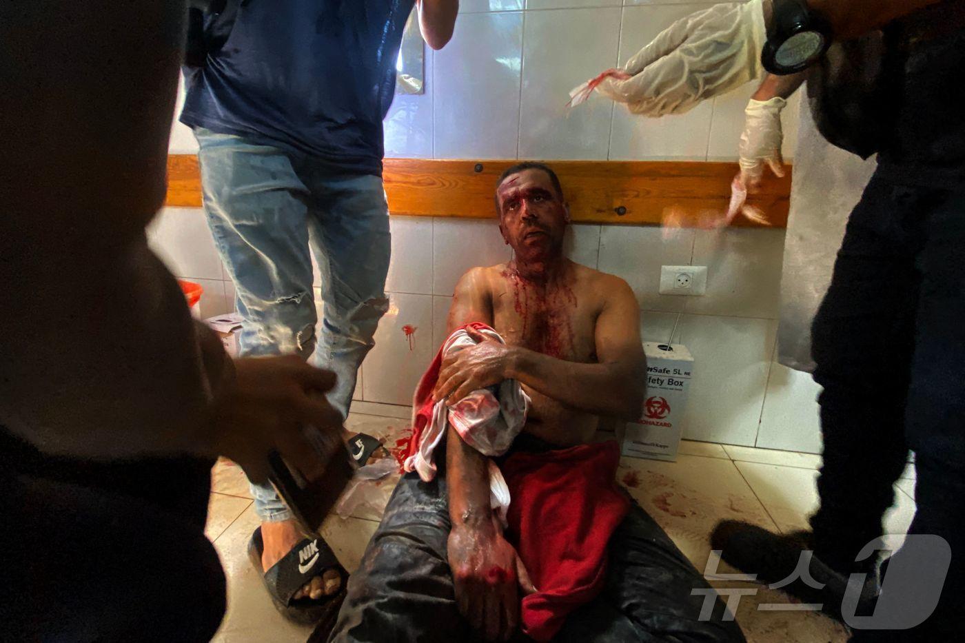 팔레스타인 사진기자 하템 오마르가 지난 8월 25일&#40;현지시간&#41; 가자지구 남부 칸 유니스에 위치한 나세르 병원에서 이스라엘의 공습으로 부상을 입은 뒤 치료를 기다리고 있다.2025.08.25. ⓒ AFP=뉴스1 ⓒ News1 권영미 기자