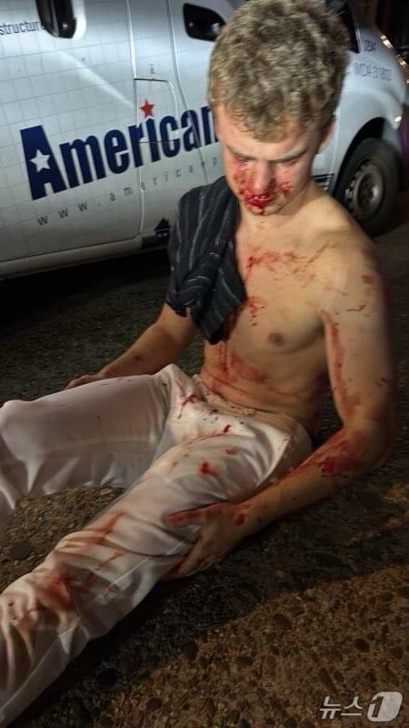 본문 이미지 - 도널드 트럼프 미국 대통령이 5일&#40;현지시간&#41; 소셜미디어 트루스소셜에 에드워드 코리스틴이 피를 흘리고 있는 사진을 올리며 워싱턴 D.C.에서 촉법소년에 대한 처벌 강화를 촉구했다. 2025.8.5./뉴스1