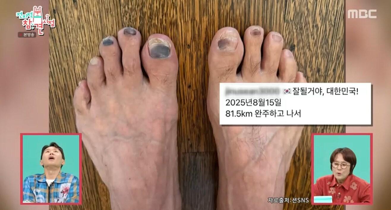 본문 이미지 - MBC '전지적 참견 시점' 캡처