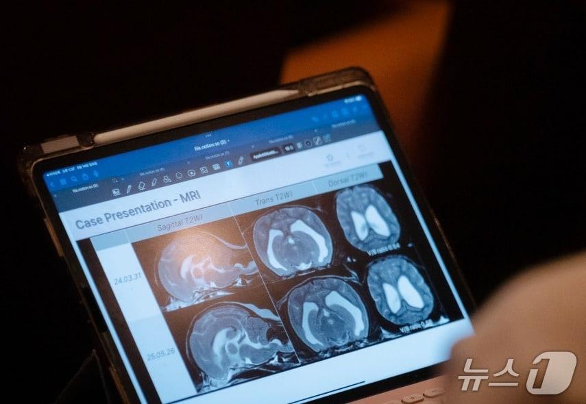 본문 이미지 - 14일 열린 &#39;제2회 벳아너스 증례 교류 심포지엄&#40;CES&#41;&#39;에서 한 참석자가 MRI 발표 자료를 보고 있다&#40;벳아너스 제공&#41;. ⓒ 뉴스1