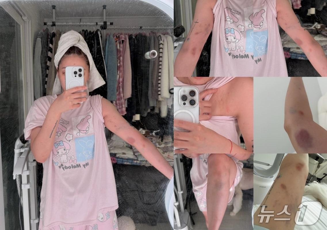 본문 이미지 - &#40;SNS 갈무리&#41;