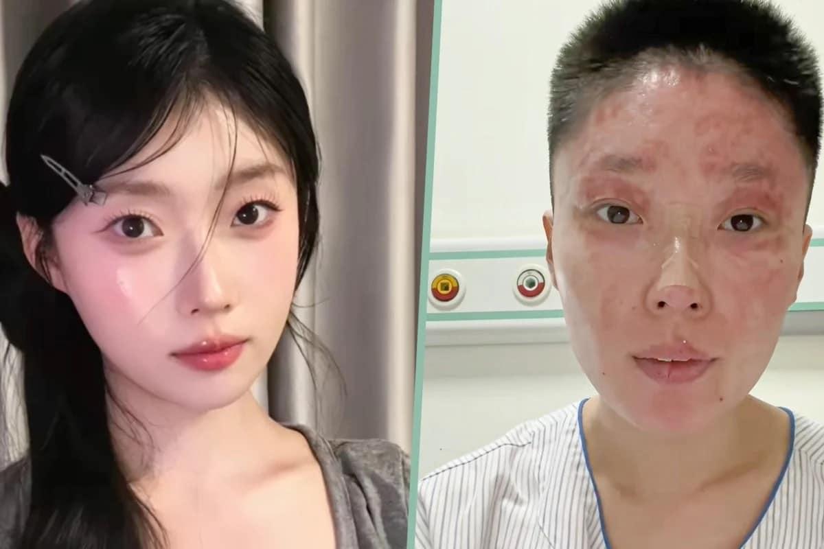 본문 이미지 - (SCMP 갈무리)