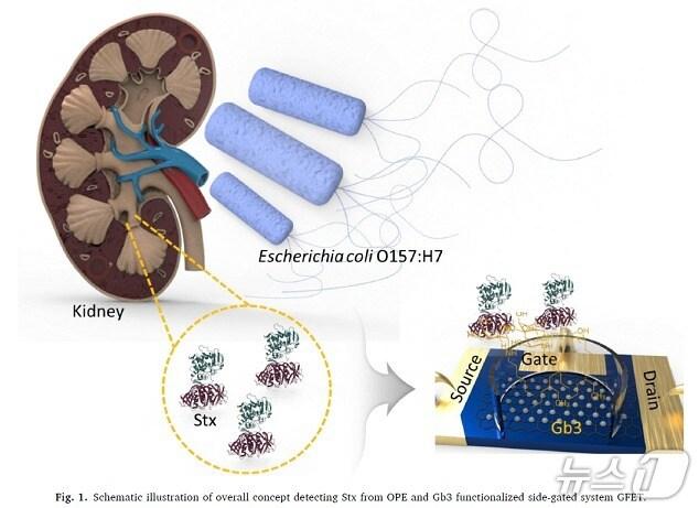 본문 이미지 - 초민감 그래핀 FET 기반 용혈성요독증후군 조기진단 개념도(생명연 제공) /뉴스1