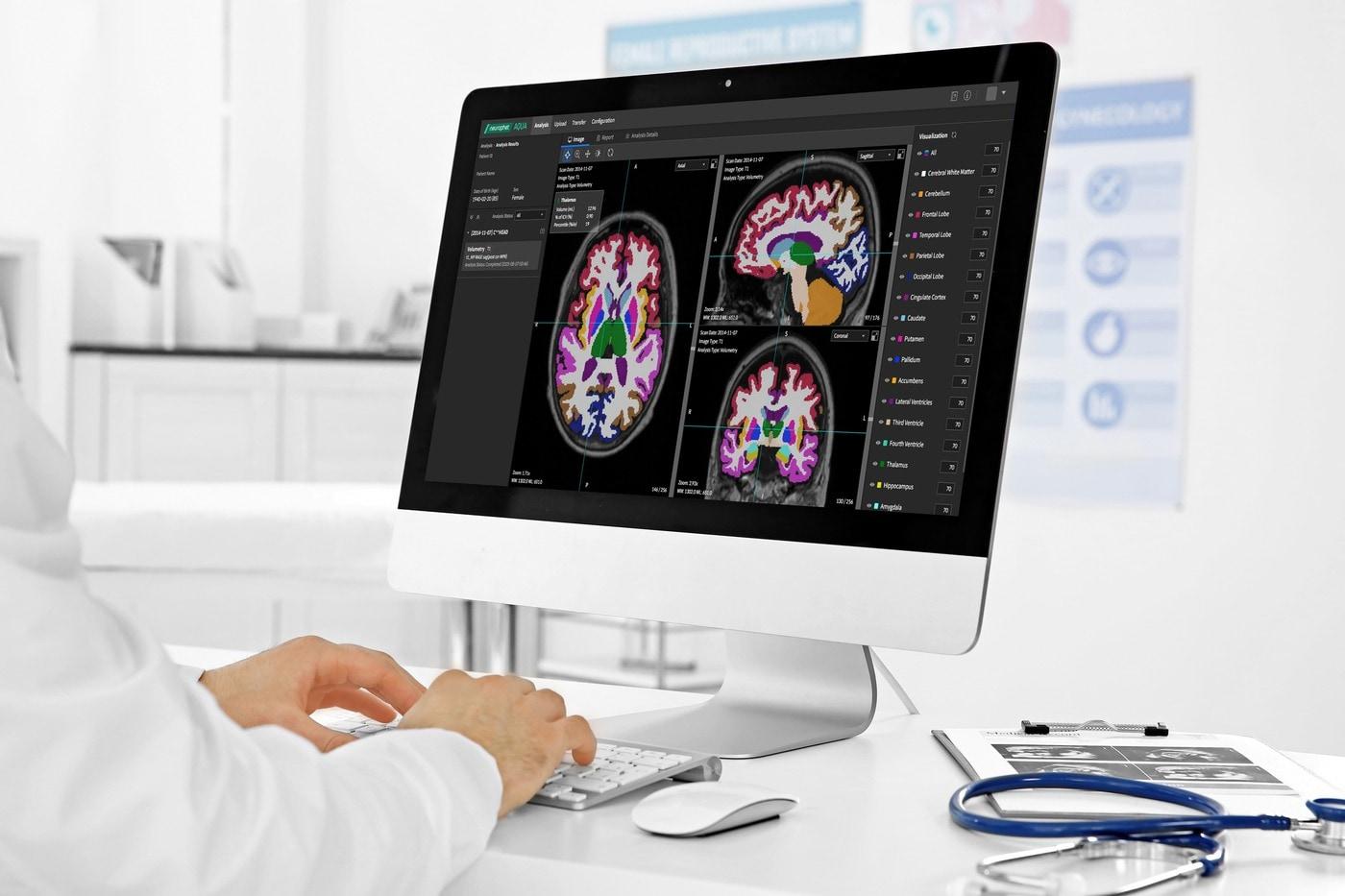 AI 진단 솔루션 &#39;뉴로핏 아쿠아&#39; 활용 모습.&#40;뉴로핏 제공&#41;/뉴스1