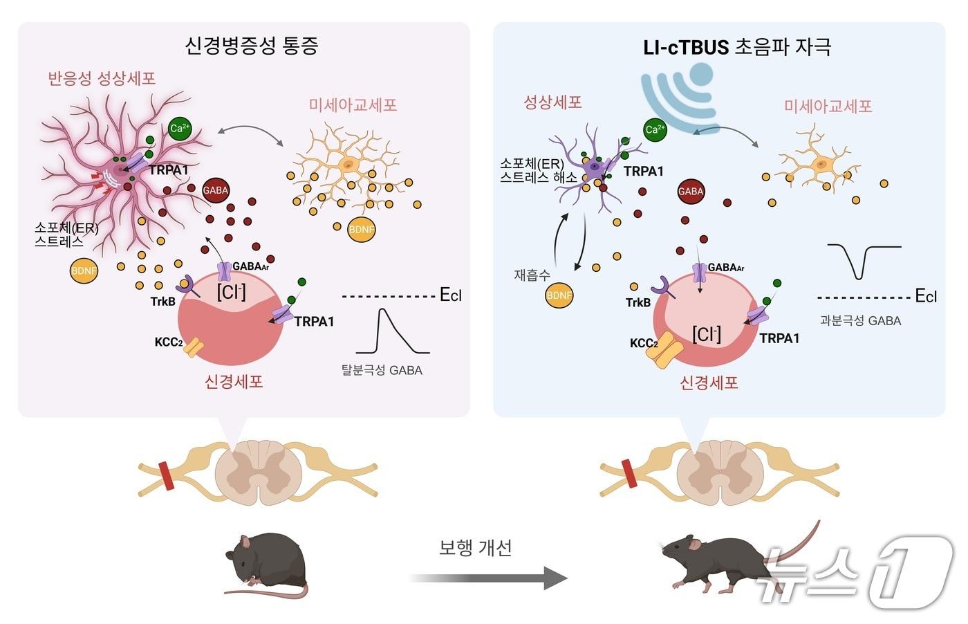 비침습적 저강도 초음파 자극이 통증을 완화하는 작동 원리(IBS 제공) /뉴스1