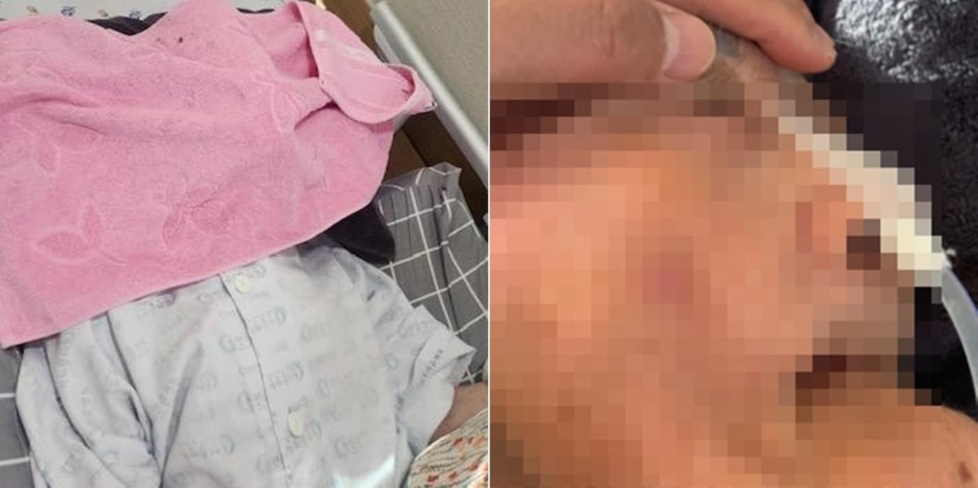 보호자가 공개한 환자사진. 출처=보배드림