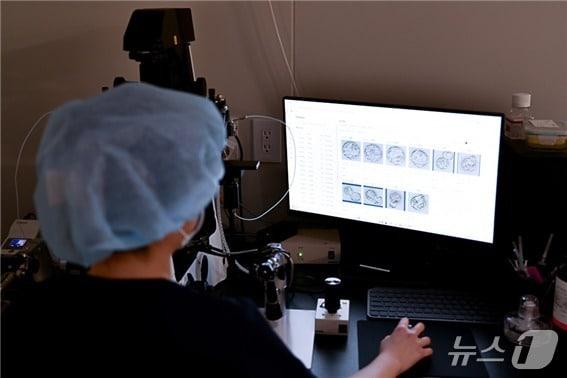 본문 이미지 - 아인병원 아인비난임센터 생식의학연구소에서 연구원이 AI 배아 분석 프로그램을 통해 배아를 선별하고 있다. (아인병원 제공.재판매 및 DB금지)