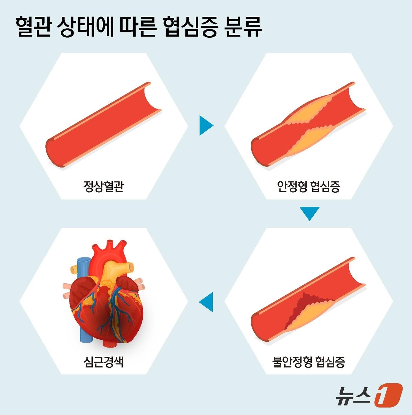 본문 이미지 - ⓒ News1 양혜림 디자이너