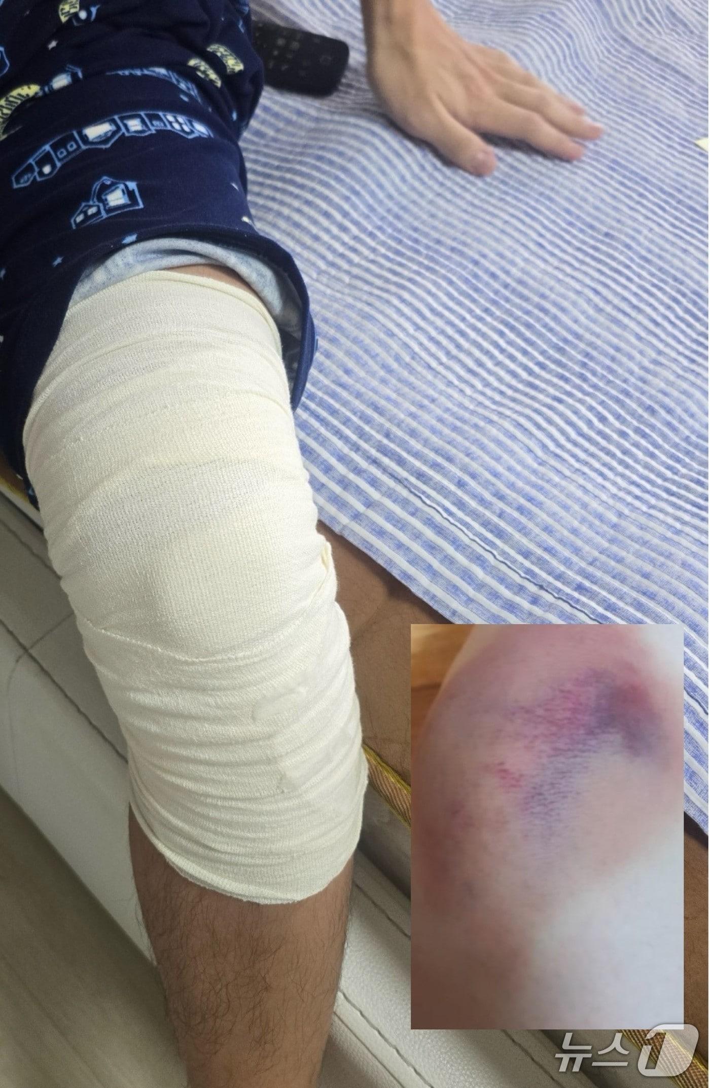 본문 이미지 - 무릎 인대 손상 등 6주의 치료를 요하는 진단을 받은 동탄 고등학교 학폭 피해자.ⓒ 뉴스1 최대호 기자.