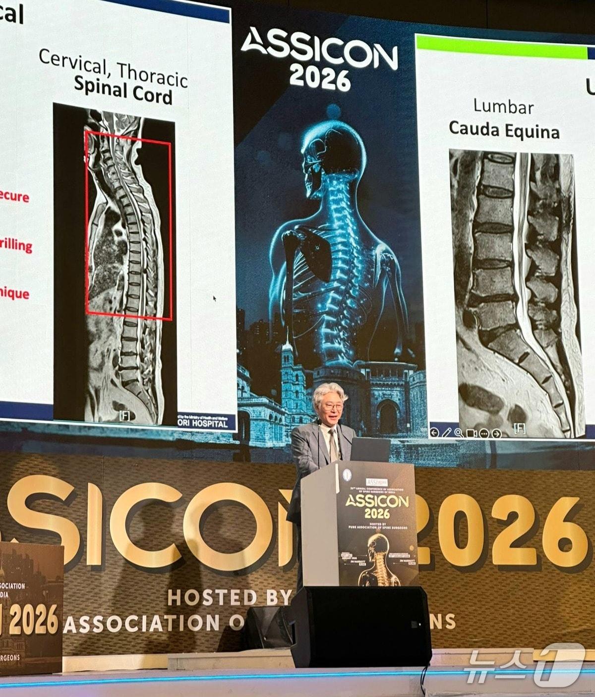 본문 이미지 - 박철웅 대전우리병원 원장이 인도 푸네에서 열린 제39회 인도척추외과학회 연례 학술대회에서 강연 중인 모습. (대전우리병원 제공, 재판매 및 DB금지) / 뉴스1