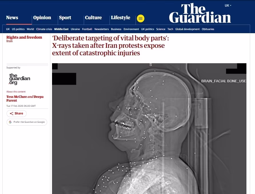 본문 이미지 - 가디언 기사 캡처. 2026.02.17