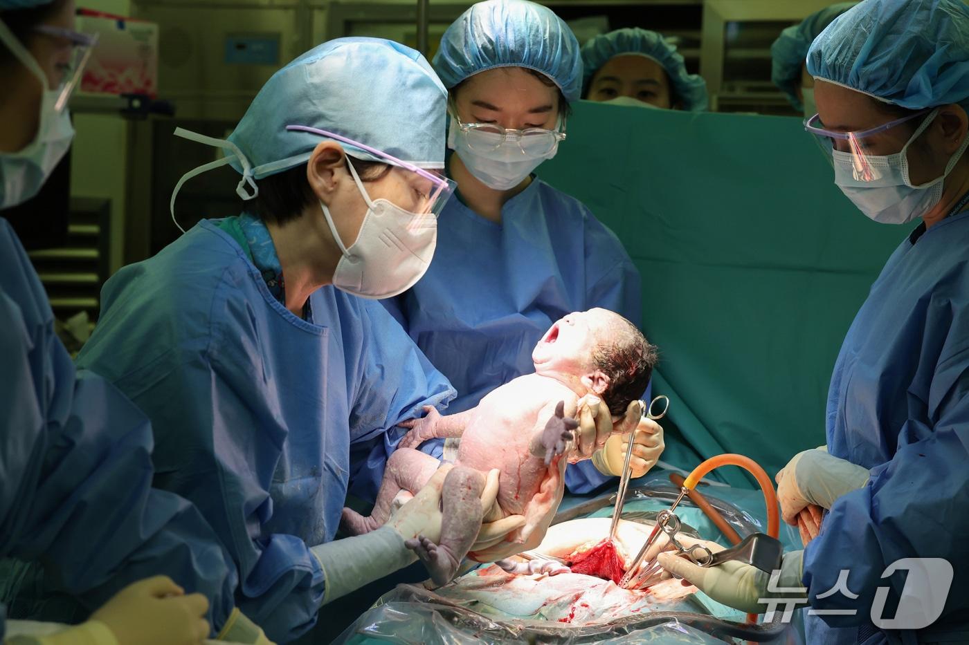 본문 이미지 - 원혜성 산부인과 교수(왼쪽에서 두 번째)가 월 300번째 분만 수술을 시행하고 있다.(서울아산병원 제공) 2026.2.19/뉴스1