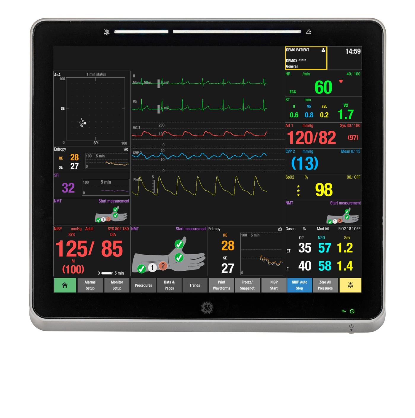 본문 이미지 - GE헬스케어의 환자모니터링 시스템 케어스케이프 캔버스(CARESCAPE Canvas)에 표기되는 'SPI 지표'. (GE헬스케어 제공)