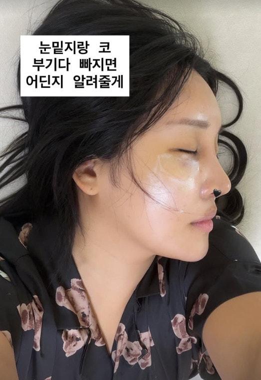 본문 이미지 - 랄랄 SNS 갈무리