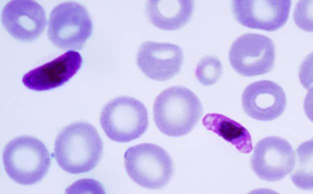 본문 이미지 - 적혈구에 침투한 말라리아 원충의 모습. (한국로슈진단 제공)