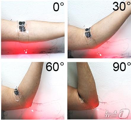 본문 이미지 - 팔에 부착한 슈퍼커패시터의 작동 시연(윤진환 서울시립대 교수 제공) /뉴스1