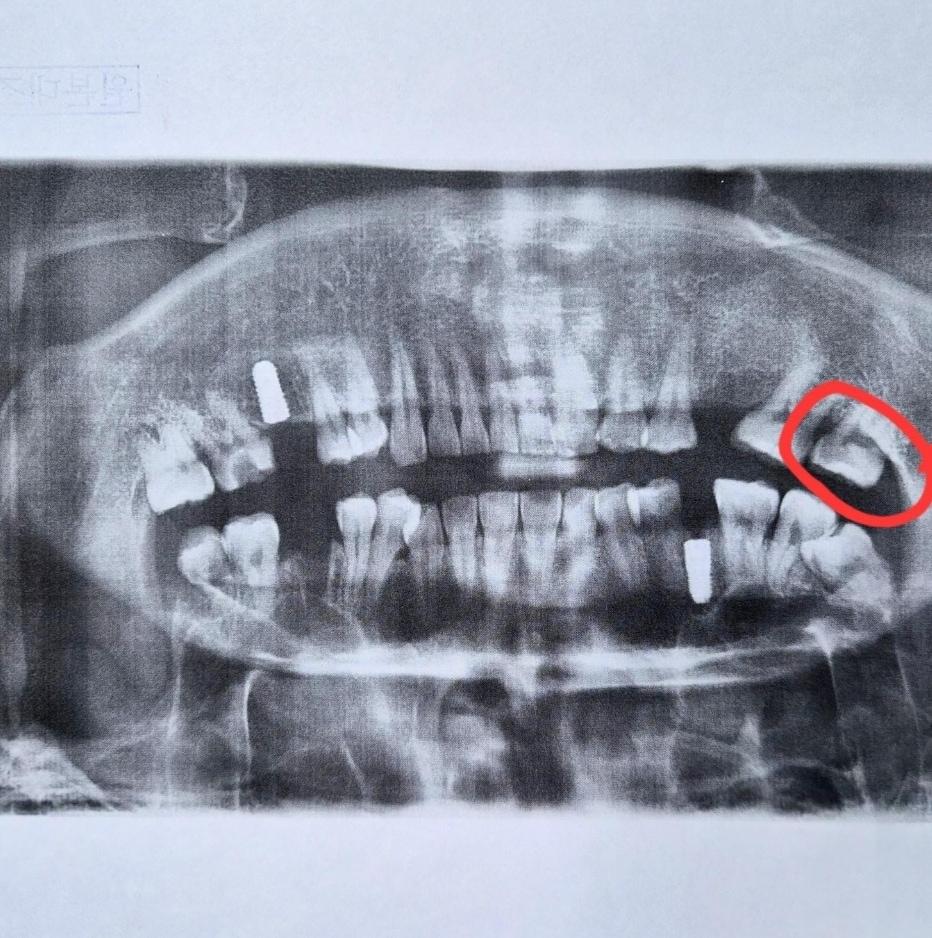 본문 이미지 - 온라인 커뮤니티