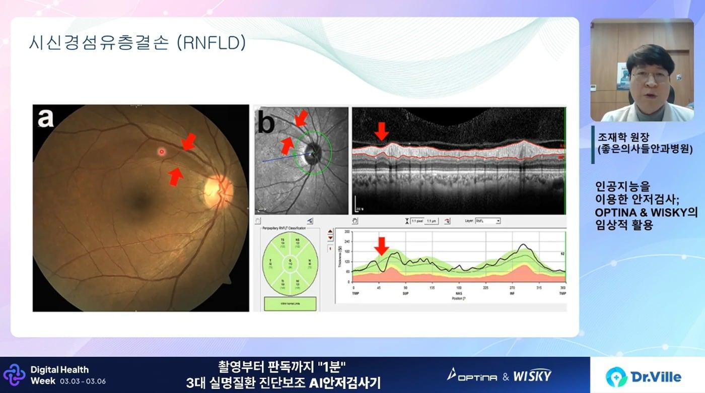 본문 이미지 - 대웅제약이 개최한 '디지털 헬스 위크 2026'에서 강연자가 발표를 하고 있다.(대웅제약 제공)/뉴스1