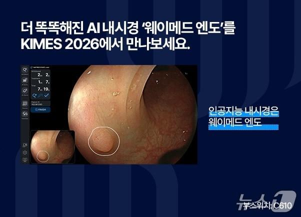 본문 이미지 - 웨이센이 오는 19일 열리는 KIMES 2026에서 한층 고도화된 AI 내시경 '웨이메드 엔도'를 선보인다. (웨이센 제공)