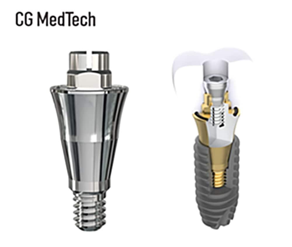 본문 이미지 - (시지메드텍 제공)