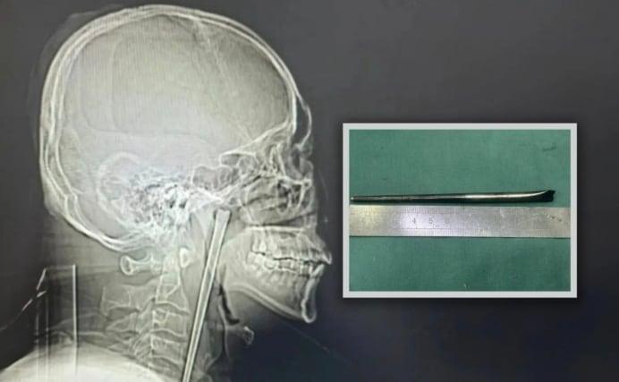 본문 이미지 - 사우스차이나모닝포스트