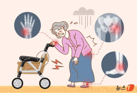 본문 이미지 - 60대 여성 이 씨는 지하철 계단에서 미끄러져 넘어졌다. 바닥에 손을 짚는 순간 통증이 느껴졌고, 병원에서 손목 골절을 진단받았다. 운이 나빴다고 여기며 "깁스 치료면 괜찮겠다"고 생각했지만, 검사 결과 골다공증으로 인한 골절이라는 사실을 알게 됐다. 의료진은 이번 골절이 척추나 고관절 등 더 심각한 골절로 이어질 수 있어 즉시 골다공증을 치료해야 한다고 설명했다. ⓒ 뉴스1 김지영 디자이너