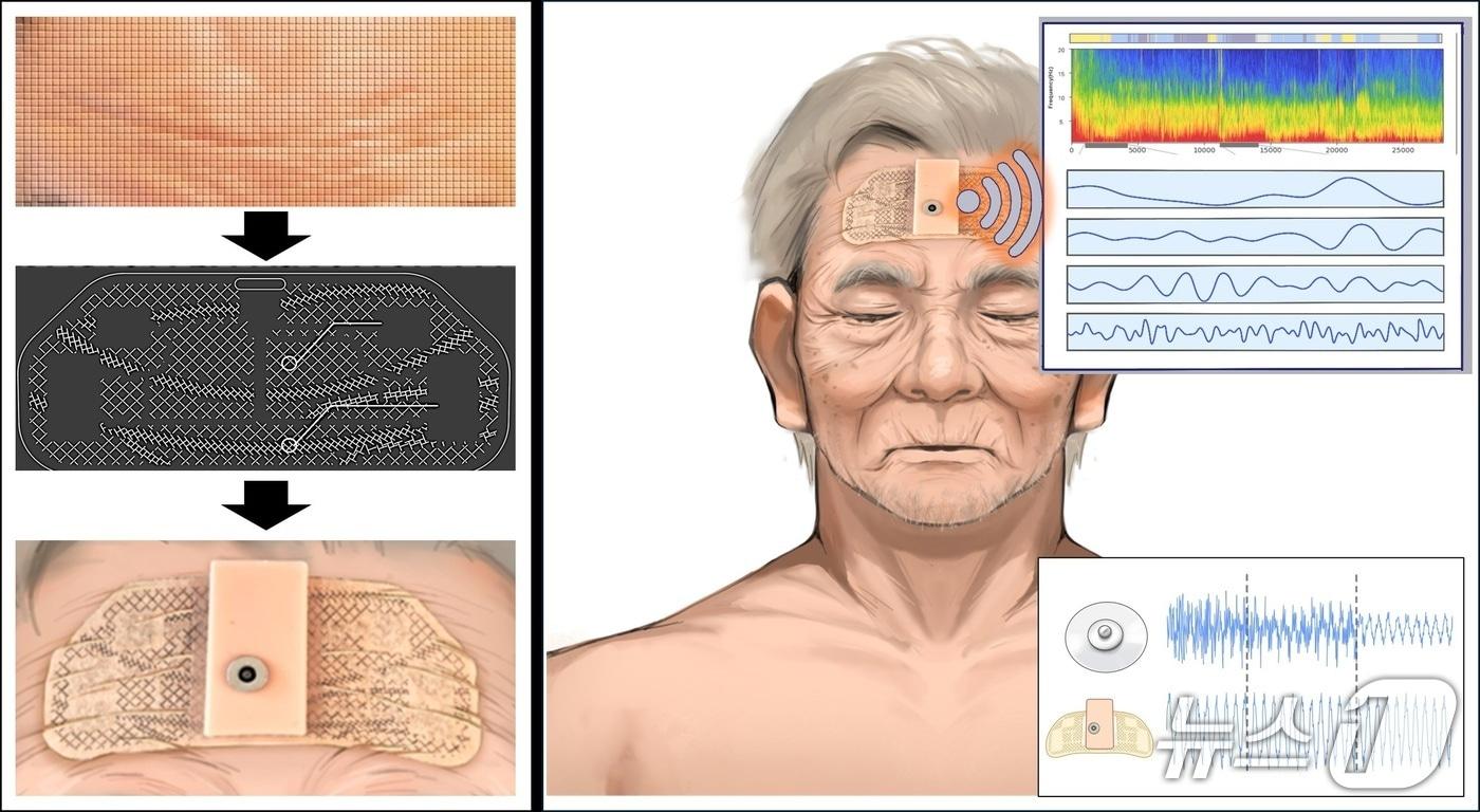 본문 이미지 - 주름 따라 움직이는 EEG 패치 모식도(충남대학교 제공.재판매 및 DB금지)/뉴스1