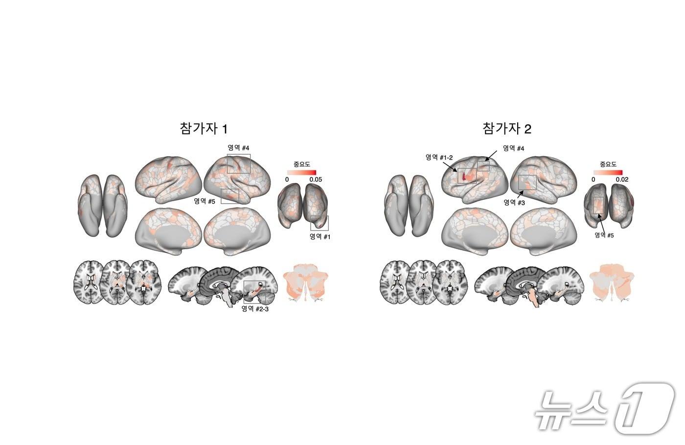 본문 이미지 - 뇌 영상 기반 만성 통증 마커의 뇌 영역별 중요도(IBS 제공) /뉴스1