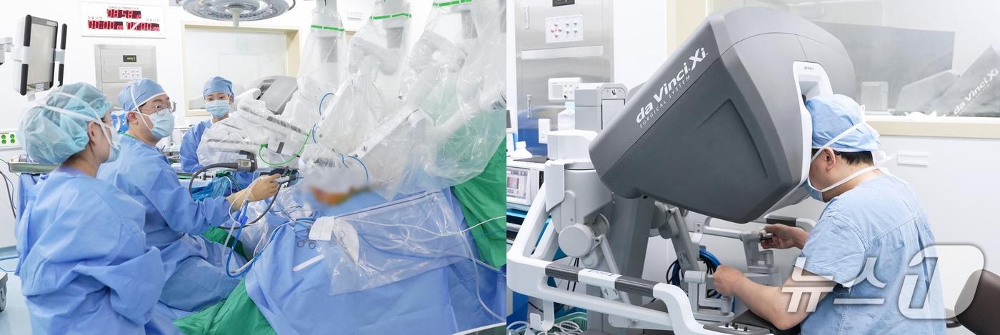 본문 이미지 - 충남대학교병원 로봇수술(충남대병원 제공) /뉴스1