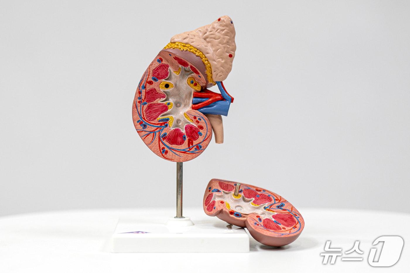 본문 이미지 - 비알코올성 지방간질환(NAFLD)이 20~30대 신장암 발생 위험을 높일 수 있다는 대규모 코호트 연구 결과가 나왔다. 사진은 신장 모형.(고려대안산병원 제공)