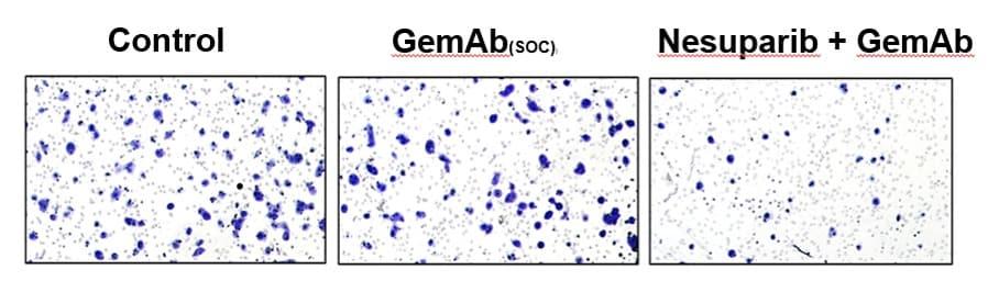 본문 이미지 - 네수파립 췌장암 세포전이 억제(제일약품 제공)