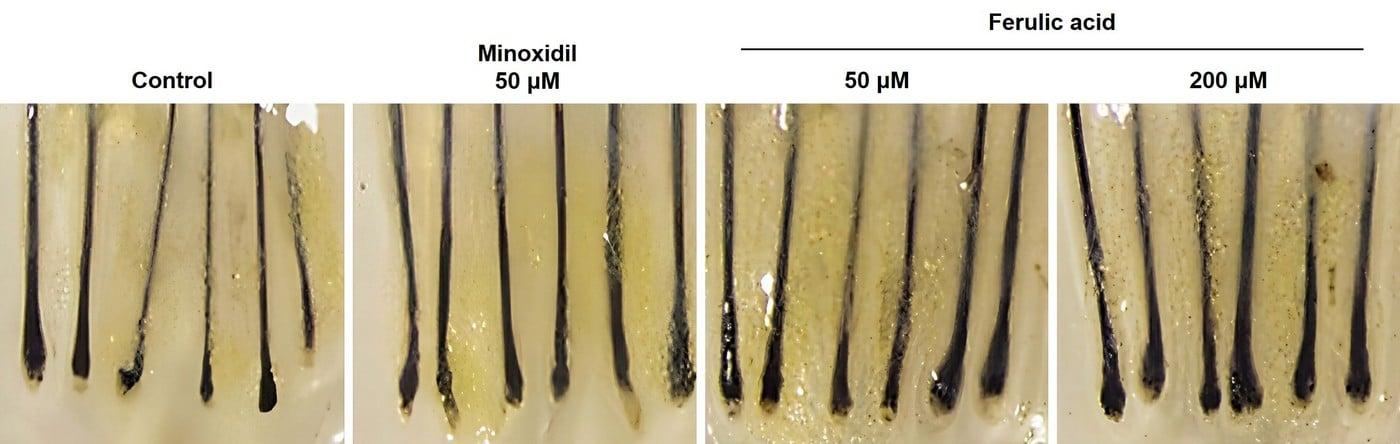본문 이미지 - 천궁 추출물 유래 발모 촉진 성분의 모발 성장기 유지 및 두께 실험 결과(LG생활건강)