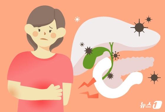 본문 이미지 - 담관암(담도암)은 비교적 잘 알려지지 않았으나, 발견이 늦어 예후가 좋지 않다고 꼽힌다.  ⓒ 뉴스1 양혜림 디자이너