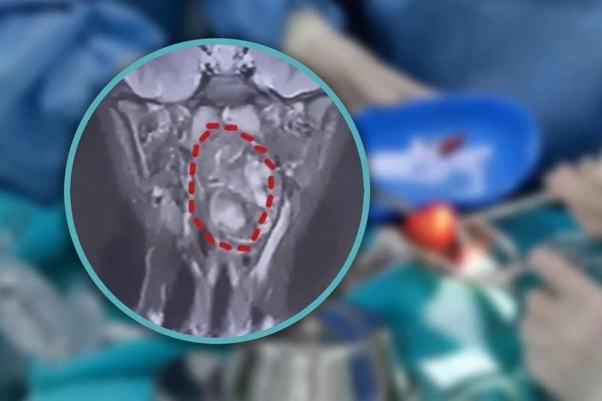 본문 이미지 - (SCMP 갈무리)