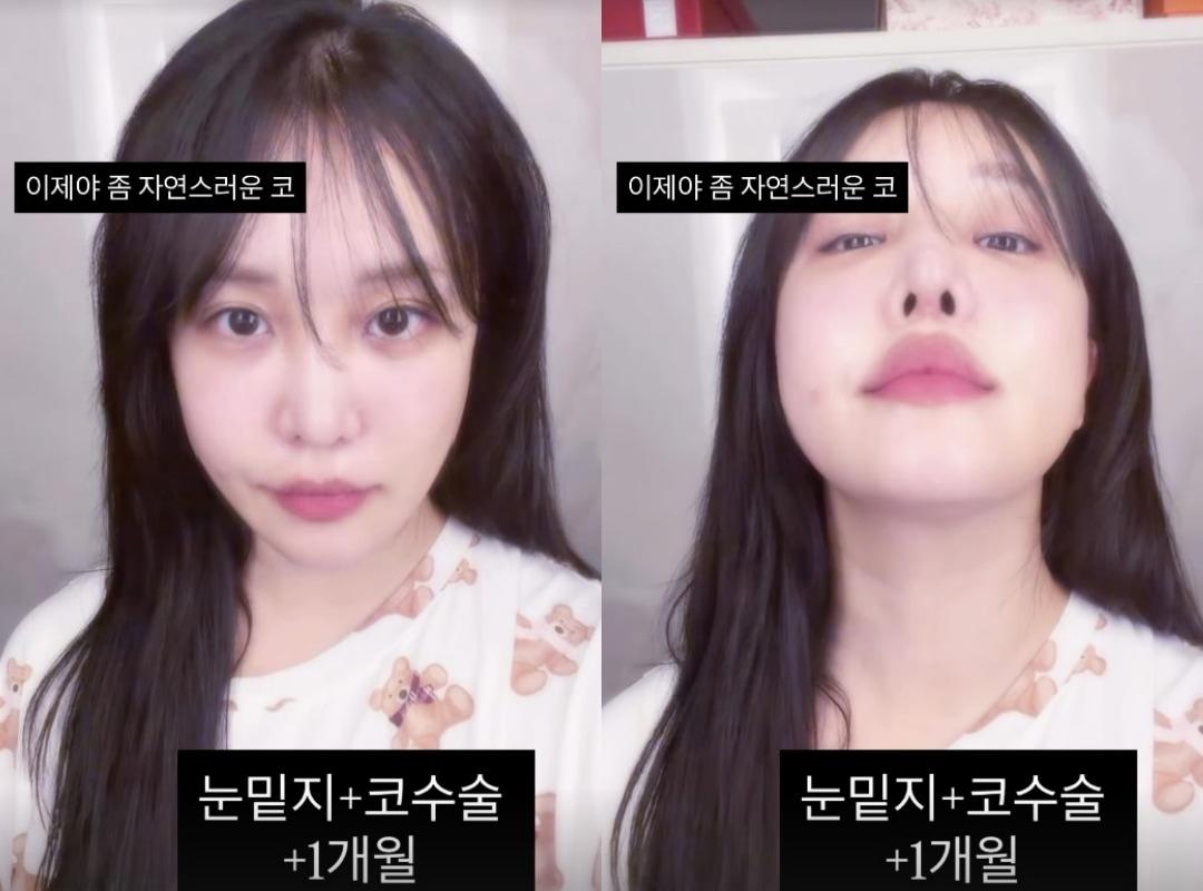 본문 이미지 - 랄랄 인스타그램 스토리