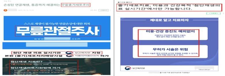 본문 이미지 - '무릎 골관절염 주사'를 첨단재생의료처럼 홍보한 광고 사례. (복지부 제공)