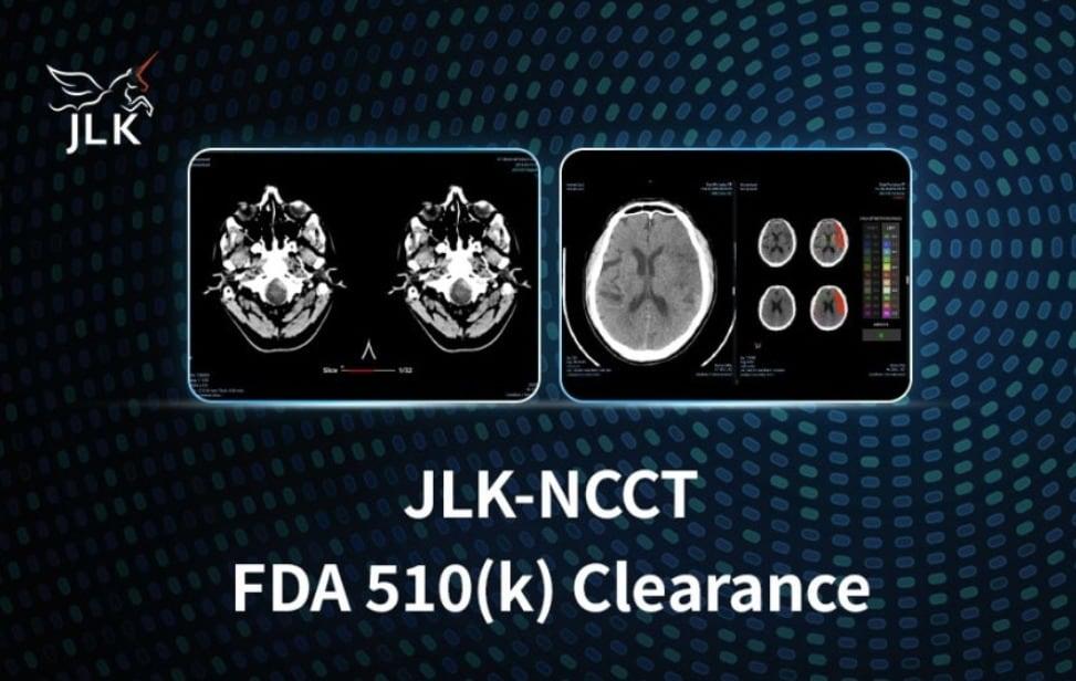 본문 이미지 - 제이엘케이, 'JLK-NCCT' 美 FDA 획득. (제이엘케이 제공)