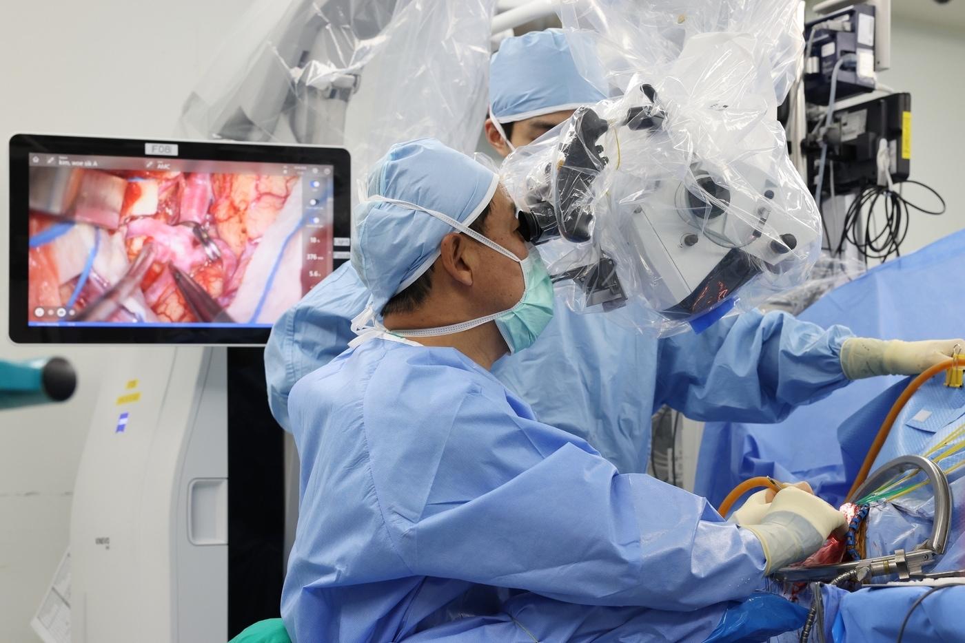 본문 이미지 - 안재성 서울아산병원 신경외과 교수가 뇌동맥류 환자를 수술하고 있는 모습.(서울아산병원 제공)