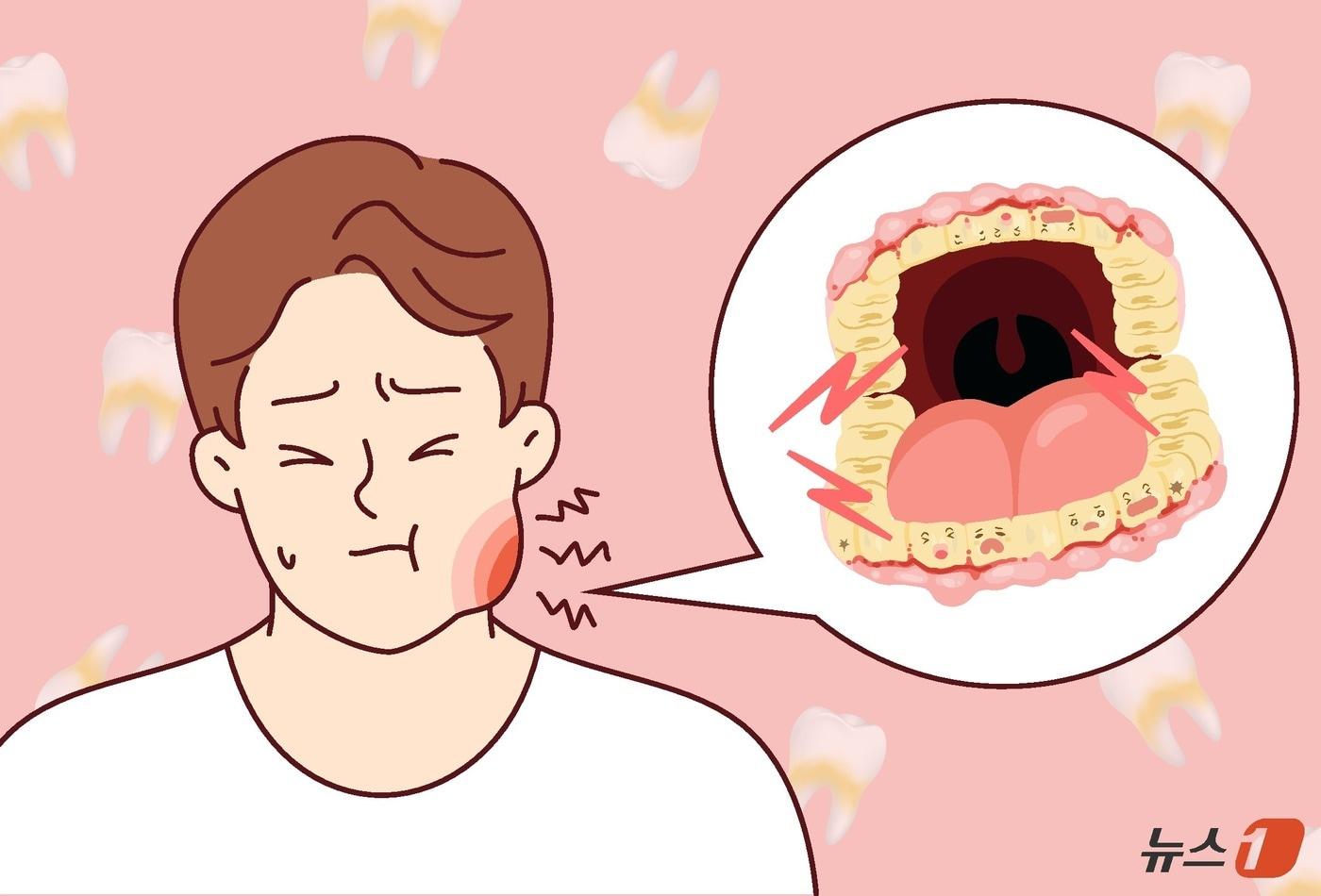 본문 이미지 - 대다수 정신장애인에게 영구치 '충치'가 확인되는 등 일부 장애유형의 구강건강 문제가 심각하다는 지적이 제기됐다. 구강건강관리가 취약한 장애인을 위해 매년 구강보건사업을 실시해야 한다는 제언도 뒤따른다. ⓒ 뉴스1 윤주희 디자이너
