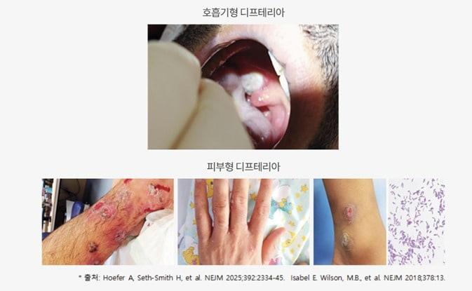 본문 이미지 - 질병관리청 제공.