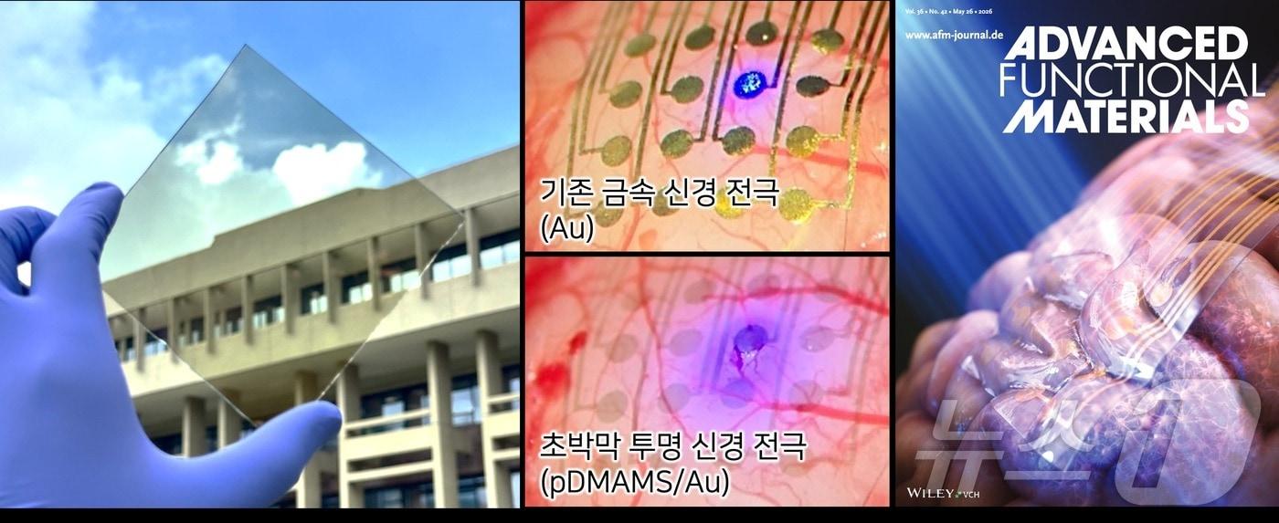본문 이미지 - 한국과학기술연구원(KIST) 연구진이 개발한 대면적 초박막 투명 신경전극. 왼쪽부터 투명 전극 실물, 기존 금속 신경전극과 초박막 투명 신경전극을 뇌 표면에 올려둔 비교 사진, 국제 학술지 '어드밴스드 펑셔널 머티리얼스'(Advanced Functional Materials) 표지 이미지. 개발된 전극은 뇌 표면이 비칠 정도로 투명해 빛을 통과시키면서 뇌 신호를 측정할 수 있다. (KIST 제공)