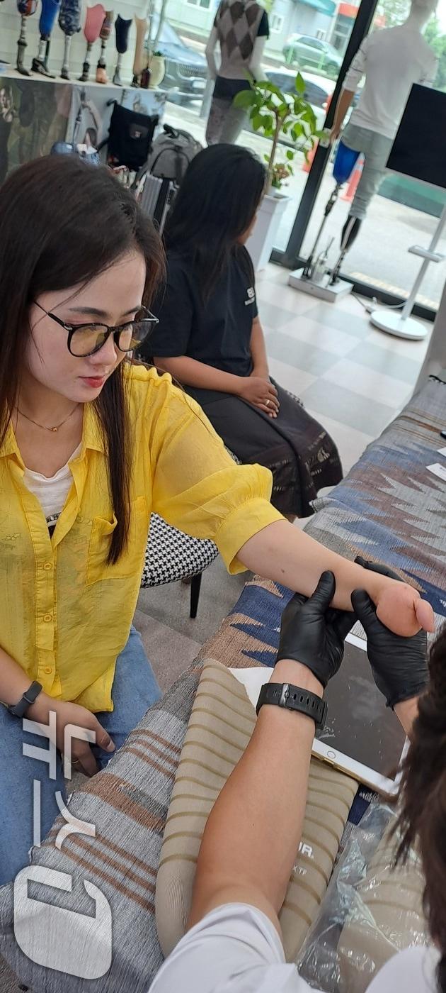 본문 이미지 - 19일 전남광주의 한 의족제작소에서 의수 대상자인 라오스 여성 깜웬이 검진을 받고 있다. (사단법인 글로벌프랜드 제공. 재판매 및 DB 금지) 2026.7.19 
