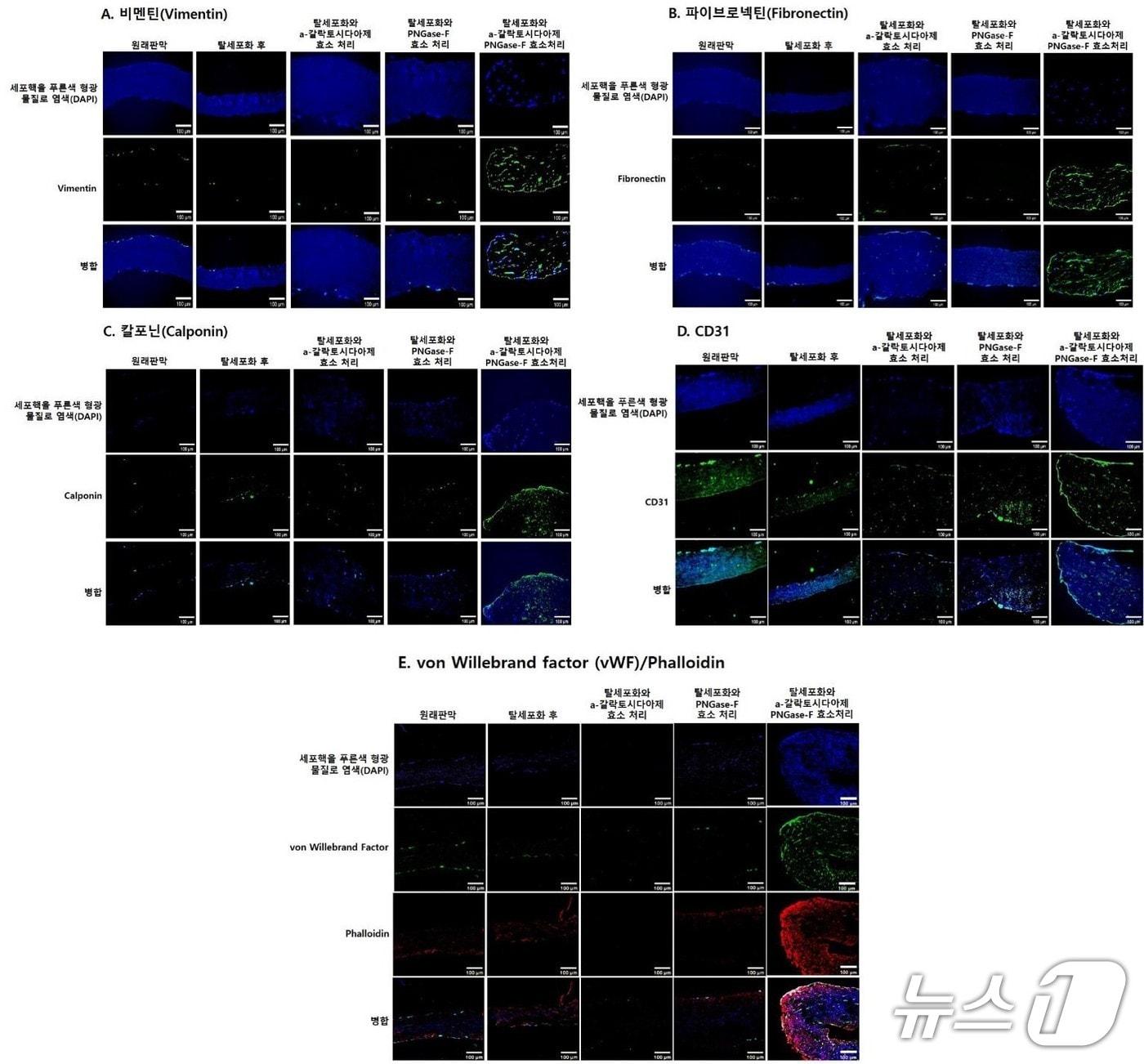 본문 이미지 - 체외 재세포화 실험: α-갈락토시다아제와 PNGase-F로 함께 처리한 이종조직판막에 사람 줄기세포를 56일째 단일배양했을 때, 재세포화가 촉진돼 관련 단백질 발현이 증가했다.(초록색/빨간색)(서울대병원 제공)