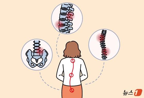 본문 이미지 - 우리 몸을 지탱하는 기둥인 척추는 정면에서 봤을 때 일자 형태, 측면에서는 완만한 S자 곡선을 이루며 신체 균형을 유지하는 중요한 구조물이다. 그러나 다양한 원인으로 균형이 무너지면 단순한 외형 변화에 그치지 않고 통증과 기능 저하를 동반하는 질환으로 이어질 수 있다. ⓒ 뉴스1 양혜림 디자이너