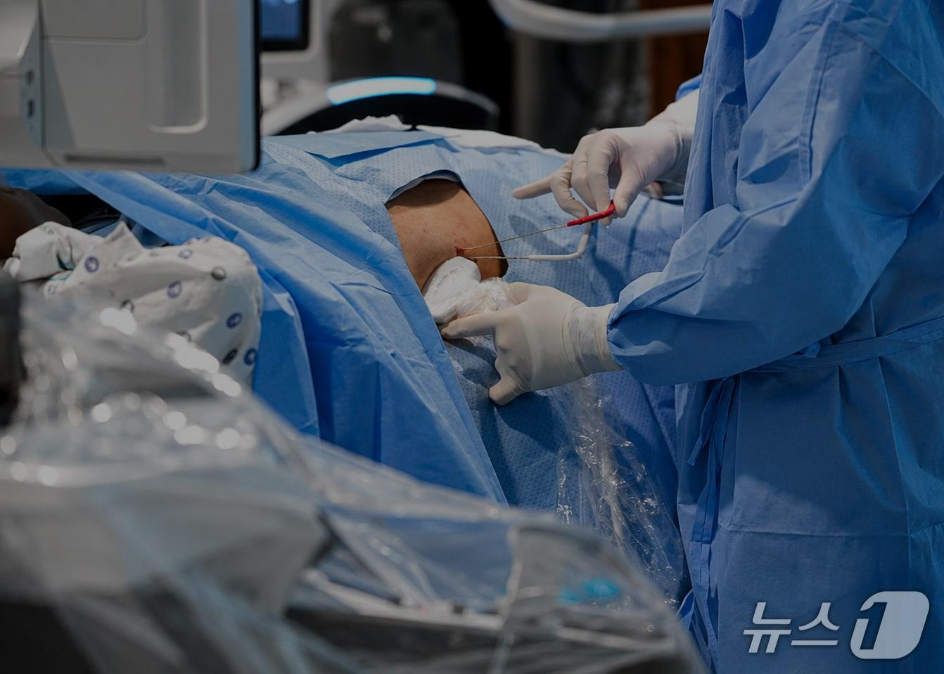 본문 이미지 - 최현욱 영상의학과 주임과장이 암냉동제거술을 시행하고 있다.(동남권원자력의학원 제공. 재판매 및 DB금지)