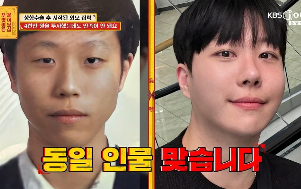 본문 이미지 - KBS Joy '무엇이든 물어보살' 화면 캡처