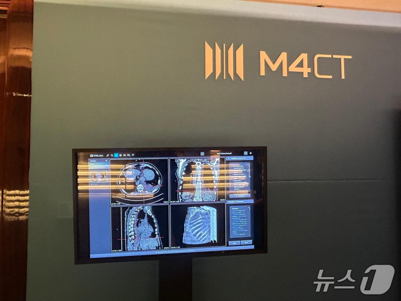 본문 이미지 - 딥노이드 생성형 AI 의료기기 'M4CXR'. ⓒ 뉴스1 문대현 기자